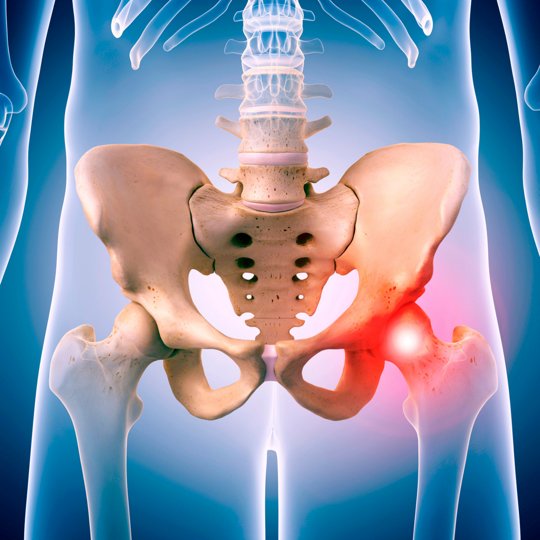 Acute hip pain relieve